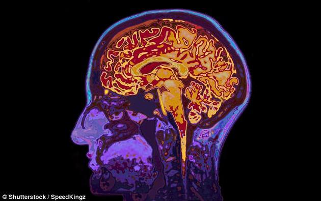 研究人員著重觀察了三個腦區：背內側前額葉皮質、尾狀核、以及丘腦。