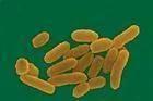 在病灶標(biāo)本中 圖2。鼠疫桿菌Yersing pestis（圖片來源：搜狗百科[2]）